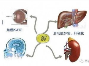 铜铜铜铜铜铜好多疼如何有效缓解铜中毒症状铜中毒？排铜口服液，天然安全，快速排铜