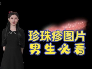 小兄弟里面有白色物质，可能是珍珠疹，也可能是包皮垢