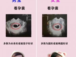 生男生女可选择孕妇怀孕，科学鉴定胎儿性别