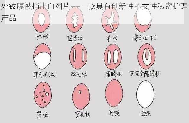 处钕膜被捅出血图片——一款具有创新性的女性私密护理产品